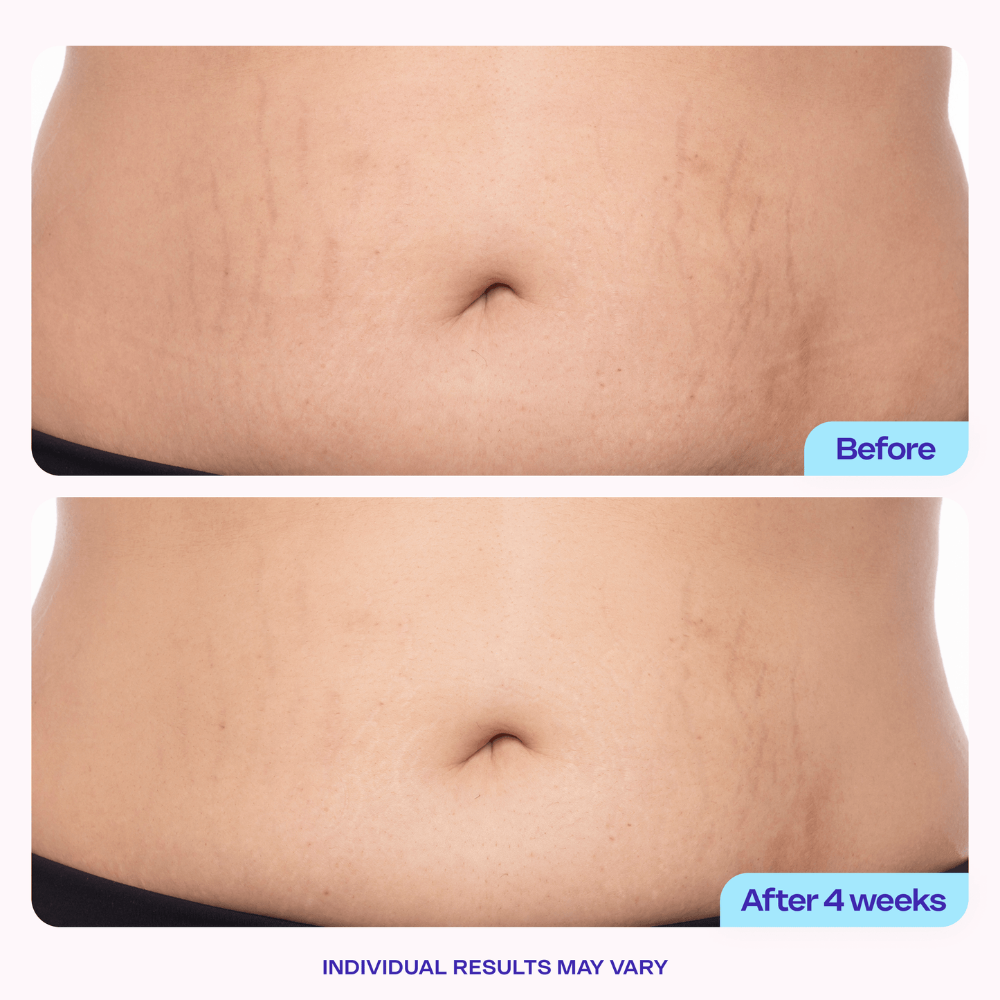 Belly Cream