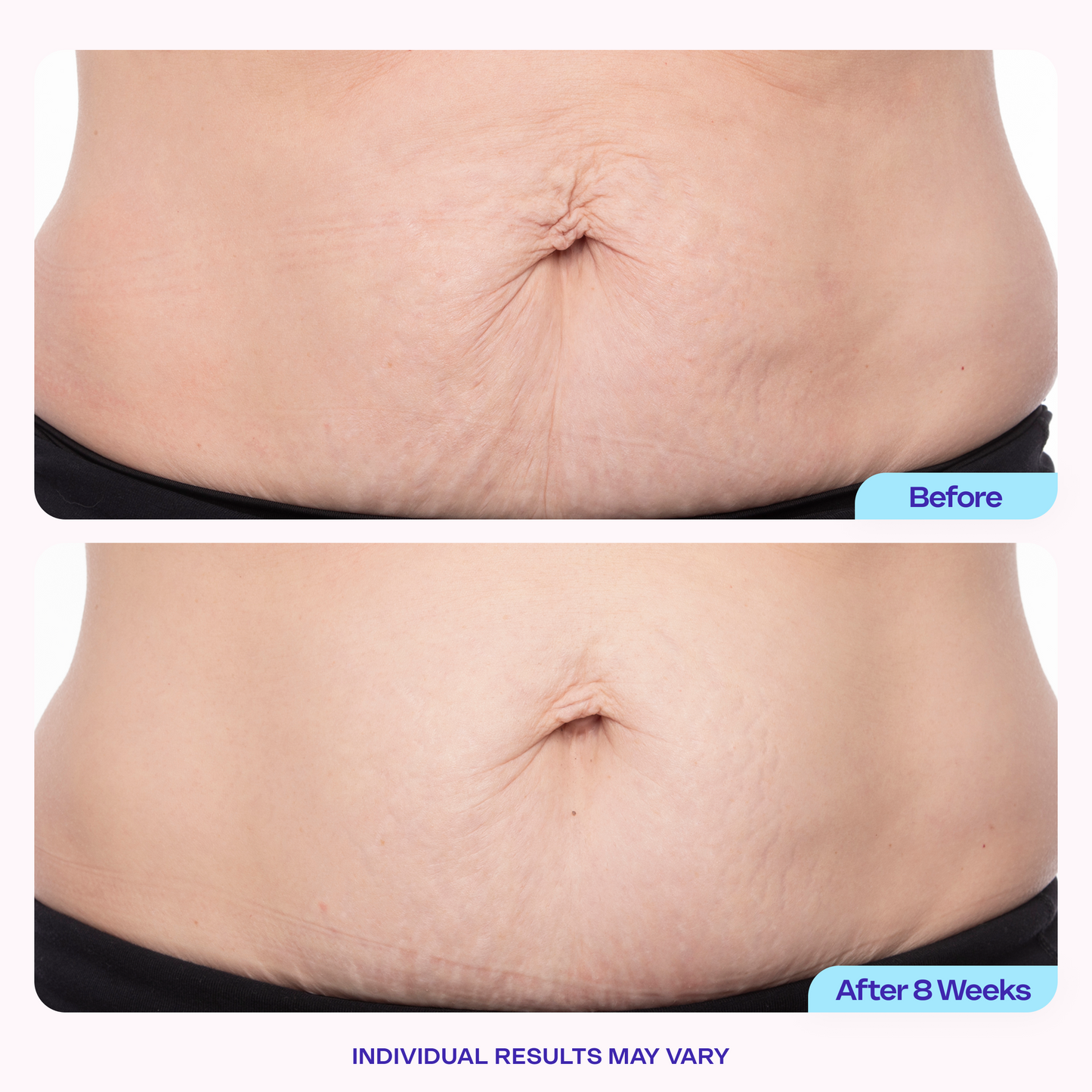 BELLY CREAM