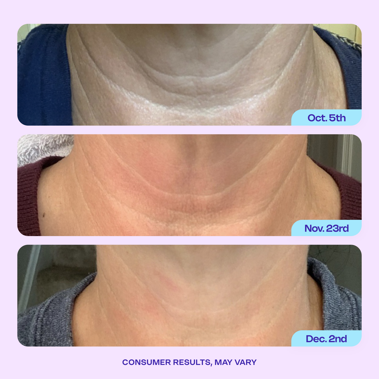NECK CREAM