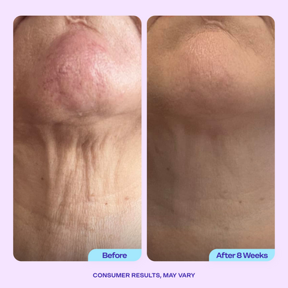 NECK CREAM